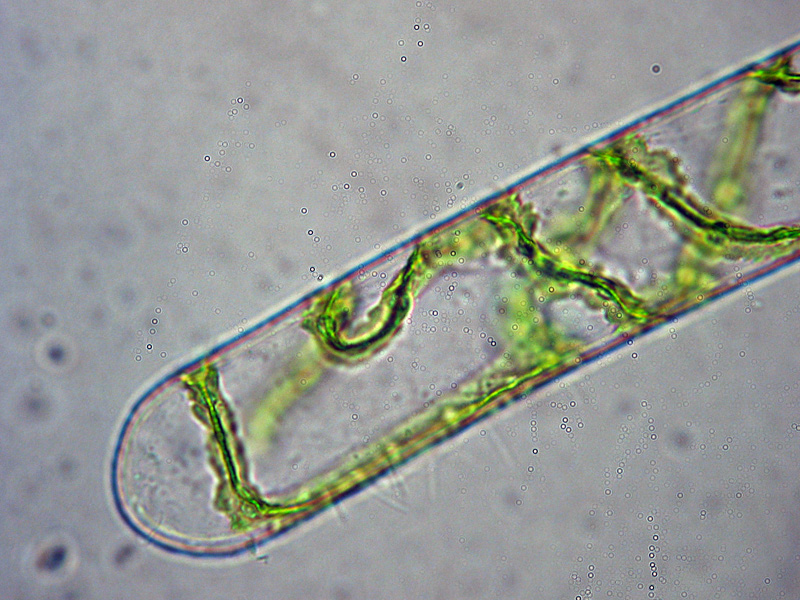 Dove finisce la Spirogyra...